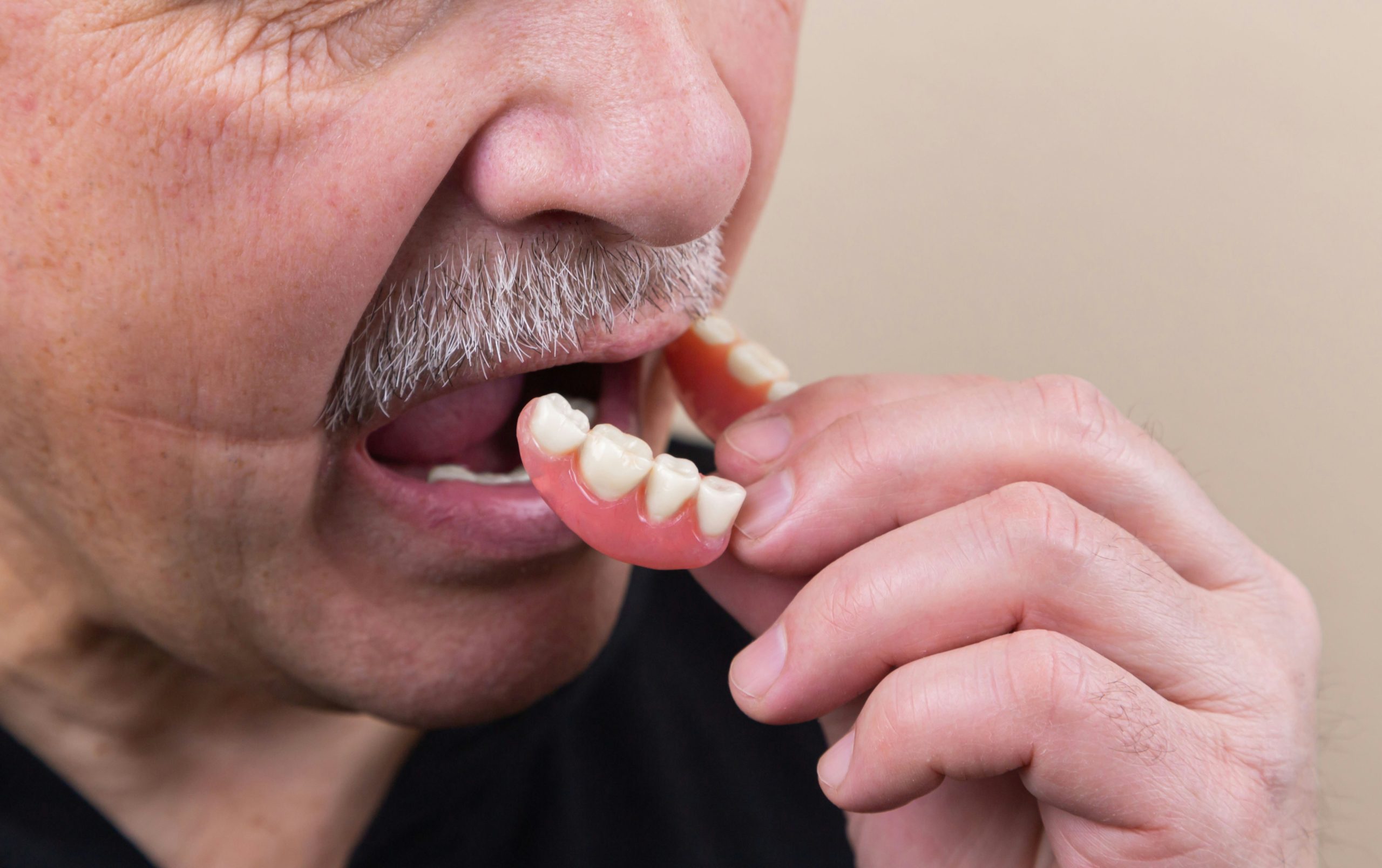 Understanding the Different Types of Dentures and Finding the Right Fit for You
